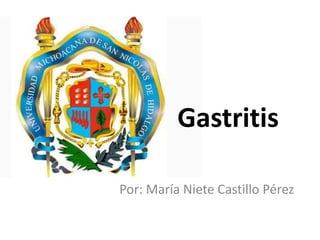 Gastritis
Por: María Niete Castillo Pérez
 