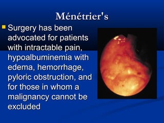 MMéénnééttrriieerr''ss 
 SSuurrggeerryy hhaass bbeeeenn 
aaddvvooccaatteedd ffoorr ppaattiieennttss 
wwiitthh iinnttrraaccttaabbllee ppaaiinn,, 
hhyyppooaallbbuummiinneemmiiaa wwiitthh 
eeddeemmaa,, hheemmoorrrrhhaaggee,, 
ppyylloorriicc oobbssttrruuccttiioonn,, aanndd 
ffoorr tthhoossee iinn wwhhoomm aa 
mmaalliiggnnaannccyy ccaannnnoott bbee 
eexxcclluuddeedd 
 