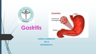 Gastritis
KARINA ZAMBRANO
4TO B
INFORMATICA
 