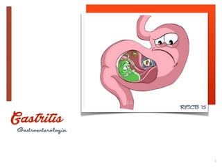 1
Gastritis
Gastroenterología
RECB '15
 