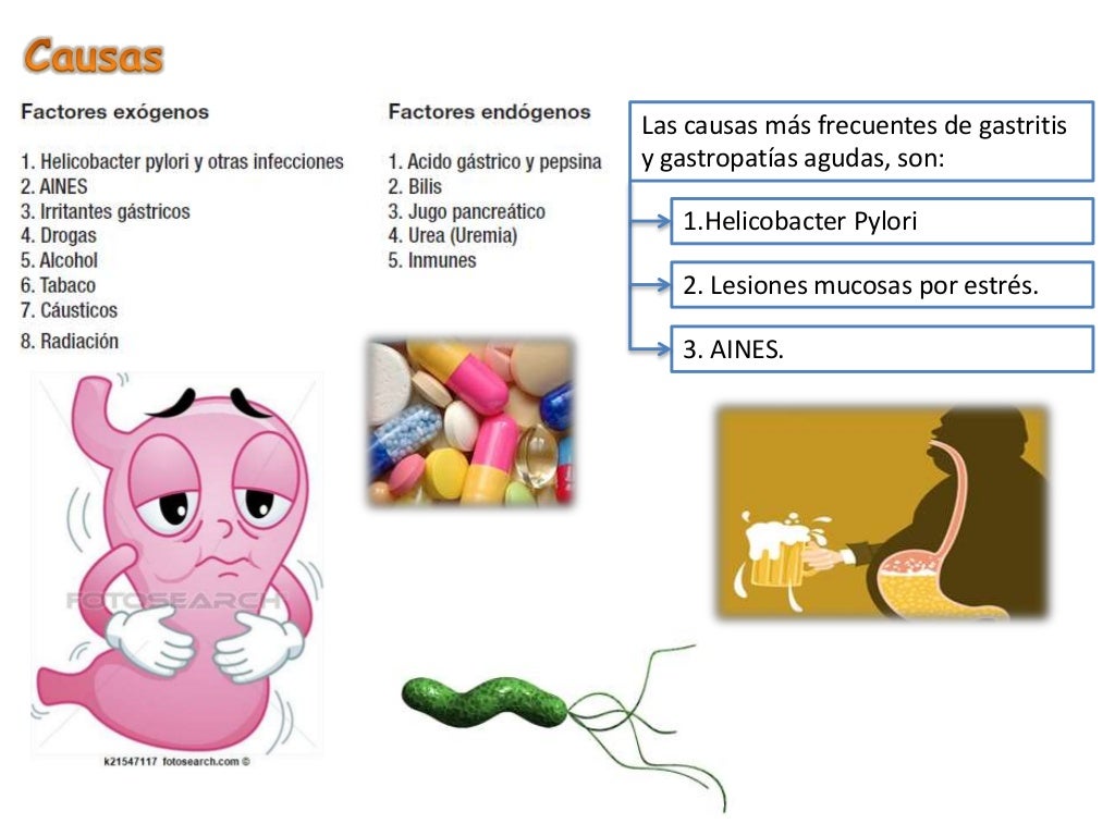 Gastritis