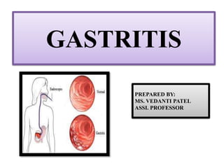 GASTRITIS
PREPARED BY:
MS. VEDANTI PATEL
ASSI. PROFESSOR
 