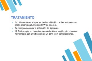 TRATAMIENTO
» 1d. Momento en el que se realiza ablación de las lesiones con
argón plasma a 2L/min con 50W de energía.
» 1e. Imagen posterior a aplicación de ligaduras.
» 1f. Endoscopia un mes después de la última sesión, sin observar
hemorragia, con erradicación de un 80% y sin complicaciones.
 