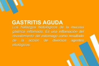 GASTRITIS AGUDA
Los hallazgos histológicos de la mucosa
gástrica inflamada. Es una inflamación del
revestimiento del estomago como resultado
de la acción de diversos agentes
etiológicos.
 