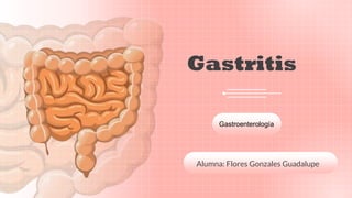 Alumna: Flores Gonzales Guadalupe
Gastritis
Gastroenterología
 