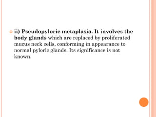  ii) Pseudopyloric metaplasia. It involves the
body glands which are replaced by proliferated
mucus neck cells, conforming in appearance to
normal pyloric glands. Its significance is not
known.
 