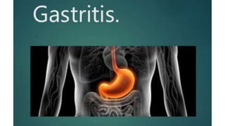 Gastritis 2019