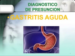 • GASTRITIS AGUDA




                    3
 