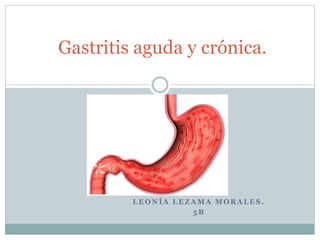 L E O N Í A L E Z A M A M O R A L E S .
5 B
Gastritis aguda y crónica.
 