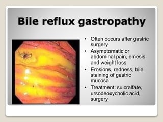 Bile reflux gastropathy
• Often occurs after gastric
surgery
• Asymptomatic or
abdominal pain, emesis
and weight loss
• Erosions, redness, bile
staining of gastric
mucosa
• Treatment: sulcralfate,
ursodeoxycholic acid,
surgery
 