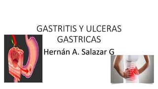 GASTRITIS Y ULCERAS
GASTRICAS
Hernán A. Salazar G
 