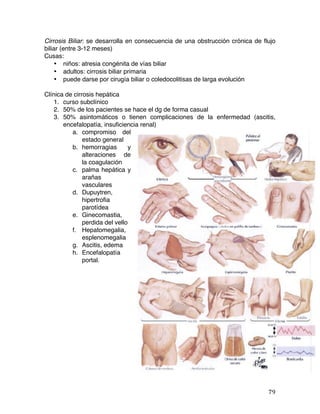   79	
  
Cirrosis Biliar: se desarrolla en consecuencia de una obstrucción crónica de flujo
biliar (entre 3-12 meses)
Cusas:
• niños: atresia congénita de vías biliar
• adultos: cirrosis biliar primaria
• puede darse por cirugía biliar o coledocolitisas de larga evolución
Clínica de cirrosis hepática
1. curso subclínico
2. 50% de los pacientes se hace el dg de forma casual
3. 50% asintomáticos o tienen complicaciones de la enfermedad (ascitis,
encefalopatía, insuficiencia renal)
a. compromiso del
estado general
b. hemorragias y
alteraciones de
la coagulación
c. palma hepática y
arañas
vasculares
d. Dupuytren,
hipertrofia
parotídea
e. Ginecomastia,
perdida del vello
f. Hepatomegalia,
esplenomegalia
g. Ascitis, edema
h. Encefalopatía
portal.
 