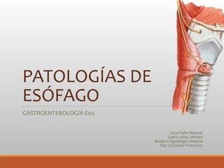 PATOLOGÍAS DE
ESÓFAGO
GASTROENTEROLOGÍA E02
Joya Peña Manuel
Loera Vélez Miriam
Madera Aguiñaga Vanessa
Paz González Franc...