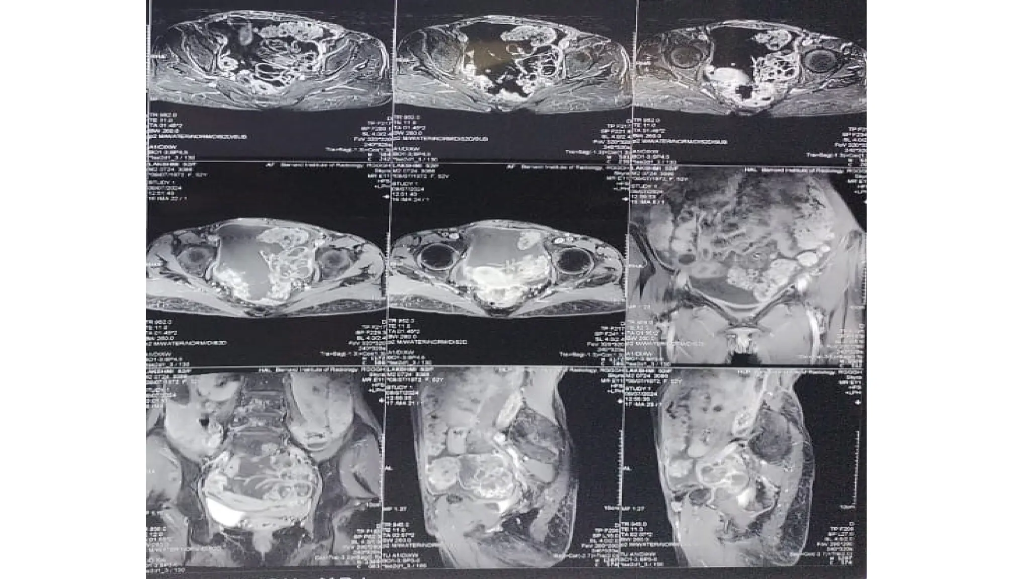 GASTRO-INTESTINALfggggggggggvggggvg.pptx