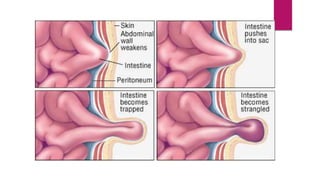 Gastro-intestinal disorders .pptx