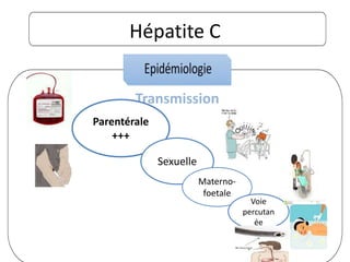 Hépatite C
Transmission
Parentérale
+++
Sexuelle
Materno-
foetale
Voie
percutan
ée
 
