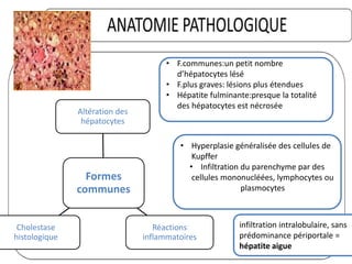 • Hyperplasie généralisée des cellules de
Kupffer
• Infiltration du parenchyme par des
cellules mononucléées, lymphocytes ou
plasmocytes
• F.communes:un petit nombre
d’hépatocytes lésé
• F.plus graves: lésions plus étendues
• Hépatite fulminante:presque la totalité
des hépatocytes est nécrosée
Formes
communes
Altération des
hépatocytes
Réactions
inflammatoires
Cholestase
histologique
infiltration intralobulaire, sans
prédominance périportale =
hépatite aigue
 