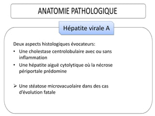 Deux aspects histologiques évocateurs:
• Une cholestase centrolobulaire avec ou sans
inﬂammation
• Une hépatite aiguë cytolytique où la nécrose
périportale prédomine
 Une stéatose microvacuolaire dans des cas
d’évolution fatale
Hépatite virale A
 