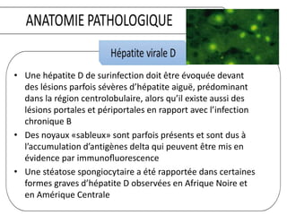 • Une hépatite D de surinfection doit être évoquée devant
des lésions parfois sévères d’hépatite aiguë, prédominant
dans la région centrolobulaire, alors qu’il existe aussi des
lésions portales et périportales en rapport avec l’infection
chronique B
• Des noyaux «sableux» sont parfois présents et sont dus à
l’accumulation d’antigènes delta qui peuvent être mis en
évidence par immunoﬂuorescence
• Une stéatose spongiocytaire a été rapportée dans certaines
formes graves d’hépatite D observées en Afrique Noire et
en Amérique Centrale
 
