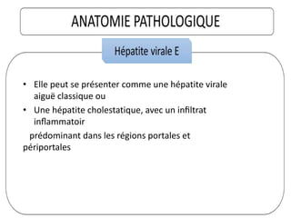 • Elle peut se présenter comme une hépatite virale
aiguë classique ou
• Une hépatite cholestatique, avec un inﬁltrat
inﬂammatoir
prédominant dans les régions portales et
périportales
 