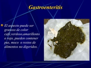 Gastroenteritis
El aspecto puede ser
grasoso de color
café,verdoso,amarillento
o rojo, pueden contener
pus, moco o restos de
alimentos no digeridos.
 