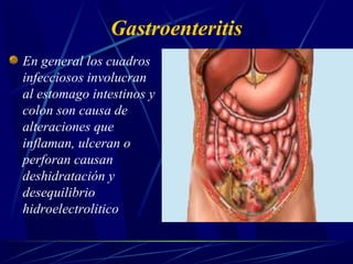Gastroenteritis
En general los cuadros
infecciosos involucran
al estomago intestinos y
colon son causa de
alteraciones que
inflaman, ulceran o
perforan causan
deshidratación y
desequilibrio
hidroelectrolitico
 