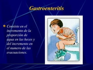Gastroenteritis
Consiste en el
incremento de la
proporción de
agua en las heces y
del incremento en
el numero de las
evacuaciones.
 