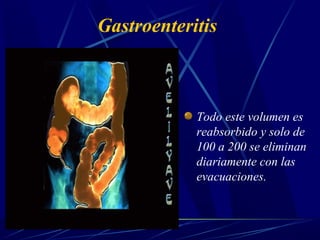 Gastroenteritis
Todo este volumen es
reabsorbido y solo de
100 a 200 se eliminan
diariamente con las
evacuaciones.
 