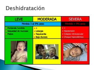 LEVE MODERADA SEVERA
Pérdida 3 al 8% peso Pérdida > 9% peso
 Fontanela hundida
 Sequedad de mucosas
 Fiebre
 +
 Letargia
 Taquicardia
 Baja diuresis
 +
 Hipotensión
 Colapso intravascular
 Choque hipovolémico
 