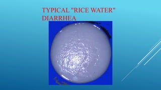 Stool Rice Water Gastroenteritis.pptx