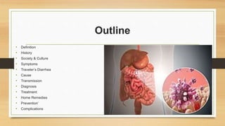Outline
• Definition
• History
• Society & Culture
• Symptoms
• Traveler’s Diarrhea
• Cause
• Transmission
• Diagnosis
• Treatment
• Home Remedies
• Prevention’
• Complications
 