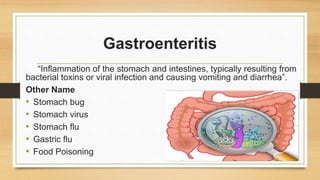 Gastroenteritis
“Inflammation of the stomach and intestines, typically resulting from
bacterial toxins or viral infection and causing vomiting and diarrhea”.
Other Name
• Stomach bug
• Stomach virus
• Stomach flu
• Gastric flu
• Food Poisoning
 