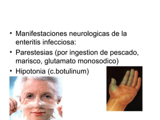 Manifestaciones neurologicas de la enteritis infecciosa: Parestesias (por ingestion de pescado, marisco, glutamato monosodico) Hipotonia (c.botulinum) 