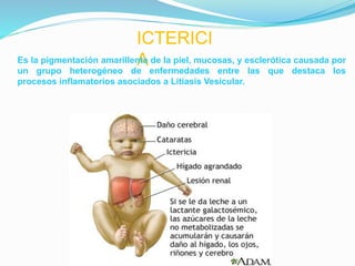 ICTERICI
AEs la pigmentación amarillenta de la piel, mucosas, y esclerótica causada por
un grupo heterogéneo de enfermedades entre las que destaca los
procesos inflamatorios asociados a Litiasis Vesicular.
 
