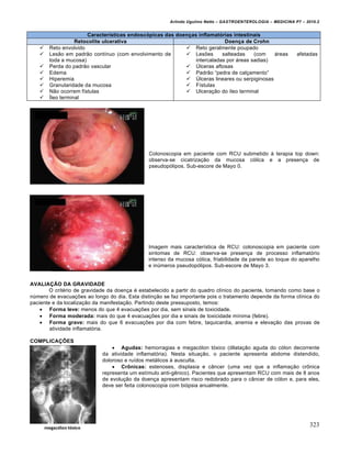 Arlindo Ugulino Netto – GASTROENTEROLOGIA – MEDICINA P7 – 2010.2
323
Características endoscópicas das doenças inflamatórias intestinais
Retocolite ulcerativa Doença de Crohn
 Reto envolvido
 Les„o em padr„o contŒnuo (com envolvimento de
toda a mucosa)
 Perda do padr„o vascular
 Edema
 Hiperemia
 Granularidade da mucosa
 N„o ocorrem fŒstulas
 ›leo terminal
 Reto geralmente poupado
 Lesƒes salteadas (com •reas afetadas
intercaladas por •reas sadias)
 ”lceras aftosas
 Padr„o “pedra de cal€amento”
 ”lceras lineares ou serpiginosas
 FŒstulas
 Ulcera€„o do Œleo terminal
Colonoscopia em paciente com RCU submetido • terapia top down:
observa-se cicatriza€„o da mucosa c‡lica e a presen€a de
pseudop‡lipos. Sub-escore de Mayo 0.
Imagem mais caracterŒstica de RCU: colonoscopia em paciente com
sintomas de RCU: observa-se presen€a de processo inflamat‡rio
intenso da mucosa c‡lica, friabilidade da parede ao toque do aparelho
e inˆmeros pseudop‡lipos. Sub-escore de Mayo 3.
AVALIAÇÃO DA GRAVIDADE
O crit‚rio de gravidade da doen€a ‚ estabelecido a partir do quadro clŒnico do paciente, tomando como base o
nˆmero de evacua€ƒes ao longo do dia. Esta distin€„o se faz importante pois o tratamento depende da forma clŒnica do
paciente e da localiza€„o da manifesta€„o. Partindo deste pressuposto, temos:
 Forma leve: menos do que 4 evacua€ƒes por dia, sem sinais de toxicidade.
 Forma moderada: mais do que 4 evacua€ƒes por dia e sinais de toxicidade mŒnima (febre).
 Forma grave: mais do que 6 evacua€ƒes por dia com febre, taquicardia, anemia e eleva€„o das provas de
atividade inflamat‡ria.
COMPLICAÇÕES
 Agudas: hemorragias e megac‡lon t‡xico (dilata€„o aguda do c‡lon decorrente
da atividade inflamat‡ria). Nesta situa€„o, o paciente apresenta abdome distendido,
doloroso e ruŒdos met•licos • ausculta.
 Crônicas: estenoses, displasia e c…ncer (uma vez que a inflama€„o cr†nica
representa um estŒmulo anti-gŠnico). Pacientes que apresentam RCU com mais de 8 anos
de evolu€„o da doen€a apresentam risco redobrado para o c…ncer de c‡lon e, para eles,
deve ser feita colonoscopia com bi‡psia anualmente.
 