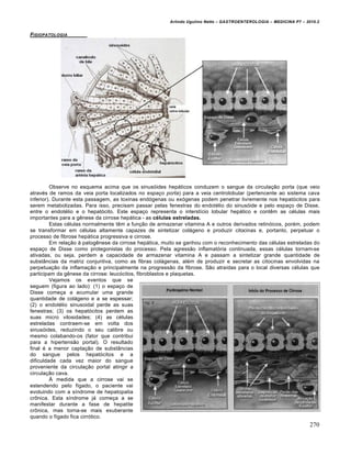 Arlindo Ugulino Netto – GASTROENTEROLOGIA – MEDICINA P7 – 2010.2
270
FISIOPATOLOGIA
Observe no esquema acima que os sinusóides hepáticos conduzem o sangue da circulação porta (que veio
através de ramos da veia porta localizados no espaço porta) para a veia centrolobular (pertencente ao sistema cava
inferior). Durante esta passagem, as toxinas endógenas ou exógenas podem penetrar livremente nos hepatócitos para
serem metabolizadas. Para isso, precisam passar pelas fenestras do endotélio do sinusóide e pelo espaço de Disse,
entre o endotélio e o hepatócito. Este espaço representa o interstício lobular hepático e contêm as células mais
importantes para a gênese da cirrose hepática - as células estreladas.
Estas células normalmente têm a função de armazenar vitamina A e outros derivados retinóicos, porém, podem
se transformar em células altamente capazes de sintetizar colágeno e produzir citocinas e, portanto, perpetuar o
processo de fibrose hepática progressiva e cirrose.
Em relação à patogênese da cirrose hepática, muito se ganhou com o reconhecimento das células estreladas do
espaço de Disse como protegonistas do processo. Pela agressão inflamatória continuada, essas células tornam-se
ativadas, ou seja, perdem a capacidade de armazenar vitamina A e passam a sintetizar grande quantidade de
substâncias da matriz conjuntiva, como as fibras colágenas, além de produzir e secretar as citocinas envolvidas na
perpetuação da inflamação e principalmente na progressão da fibrose. São atraídas para o local diversas células que
participam da gênese da cirrose: leucócitos, fibroblastos e plaquetas.
Vejamos os eventos que se
seguem (figura ao lado): (1) o espaço de
Disse começa a acumular uma grande
quantidade de colágeno e a se espessar;
(2) o endotélio sinusoidal perde as suas
fenestras; (3) os hepatócitos perdem as
suas micro vilosidades; (4) as células
estreladas contraem-se em volta dos
sinusóides, reduzindo o seu calibre ou
mesmo colabando-os (fator que contribui
para a hipertensão portal). O resultado
final é a menor captação de substâncias
do sangue pelos hepatócitos e a
dificuldade cada vez maior do sangue
proveniente da circulação portal atingir a
circulação cava.
À medida que a cirrose vai se
estendendo pelo fígado, o paciente vai
evoluindo com a síndrome de hepatopatia
crônica. Esta síndrome já começa a se
manifestar durante a fase de hepatite
crônica, mas torna-se mais exuberante
quando o fígado fica cirrótico.
 