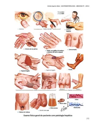 Arlindo Ugulino Netto – GASTROENTEROLOGIA – MEDICINA P7 – 2010.2
272
 