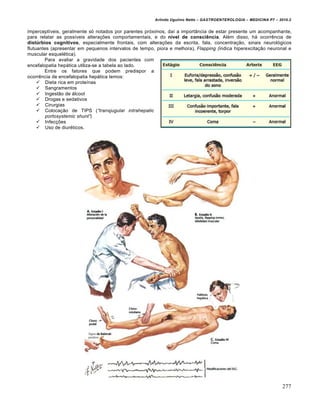Arlindo Ugulino Netto – GASTROENTEROLOGIA – MEDICINA P7 – 2010.2
277
imperceptíveis, geralmente só notados por parentes próximos, daí a importância de estar presente um acompanhante,
para relatar as possíveis alterações comportamentais, e do nível de consciência. Além disso, há ocorrência de
distúrbios cognitivos, especialmente frontais, com alterações da escrita, fala, concentração, sinais neurológicos
flutuantes (apresentar em pequenos intervalos de tempo, piora e melhora), Flapping (indica hiperexcitação neuronal e
muscular esquelética).
Para avaliar a gravidade dos pacientes com
encefalopatia hepática utiliza-se a tabela ao lado.
Entre os fatores que podem predispor a
ocorrência de encefalopatia hepática temos:
 Dieta rica em proteínas
 Sangramentos
 Ingestão de álcool
 Drogas e sedativos
 Cirurgias
 Colocação de TIPS (“transjugular intrahepatic
portosystemic shunt”)
 Infecções
 Uso de diuréticos.
 