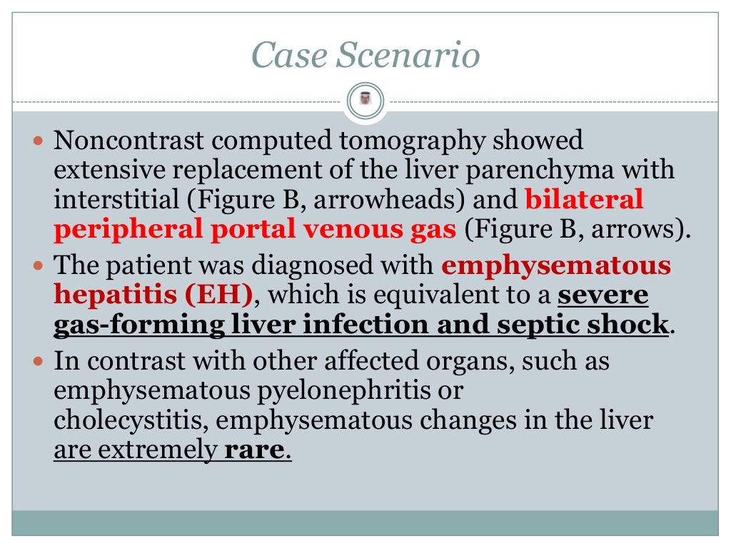 Gastroenterology Case Scenario 1