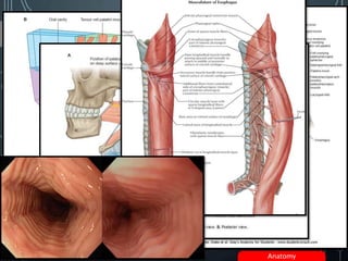 4
Anatomy
 