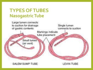 TYPES OFTUBES
NasogastricTube
 