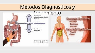 Métodos Diagnosticos y
tratamiento
 