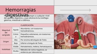 Hemorragias
digestivas
Pérdida o extravasación de sangre a cualquier nivel
del aparato digestivo, y que alcanza la luz esófago-
gástrica, intestinal o colónica.
CLASIFICACIÓN
Magnitud
del
sangrado
Aguda
Abundante, con trastornos
hemodinámicos.
Crónic
a
Pequeños volúmenes, sin trastornos
hemodinámicos.
Origen
Alta Por encima del ángulo de Treitz.
Baja Inferior al ángulo de Treitz.
Visibilidad
Visible Hematemesis, melena, hematoquecia.
Oculta
Métodos de rutina negativos, se
evidencia por laboratorios.
 