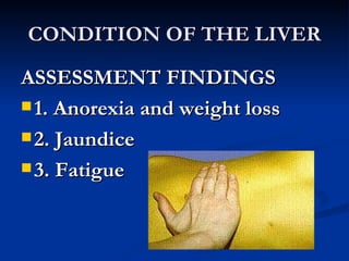 CONDITION OF THE LIVER ASSESSMENT FINDINGS 1. Anorexia and weight loss 2. Jaundice 3. Fatigue 