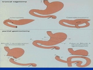 NurseReview.Org Gastrointestinal System Slide 111