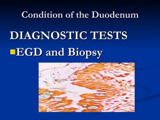 Condition of the Duodenum <ul><li>DIAGNOSTIC TESTS </li></ul><ul><li>EGD and Biopsy </li></ul>
