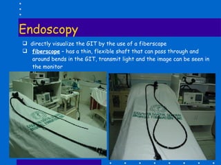 Endoscopy directly visualize the GIT by the use of a fiberscape fiberscope  – has a thin, flexible shaft that can pass through and around bends in the GIT, transmit light and the image can be seen in the monitor 
