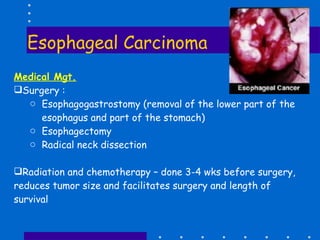 Esophageal Carcinoma Medical Mgt. Surgery : Esophagogastrostomy (removal of the lower part of the esophagus and part of the stomach)  Esophagectomy Radical neck dissection Radiation and chemotherapy – done 3-4 wks before surgery, reduces tumor size and facilitates surgery and length of survival 