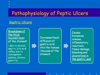 Pathophysiology of Peptic Ulcers Gastric Ulcers 
