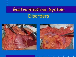 Gastrointestinal System Disorders 